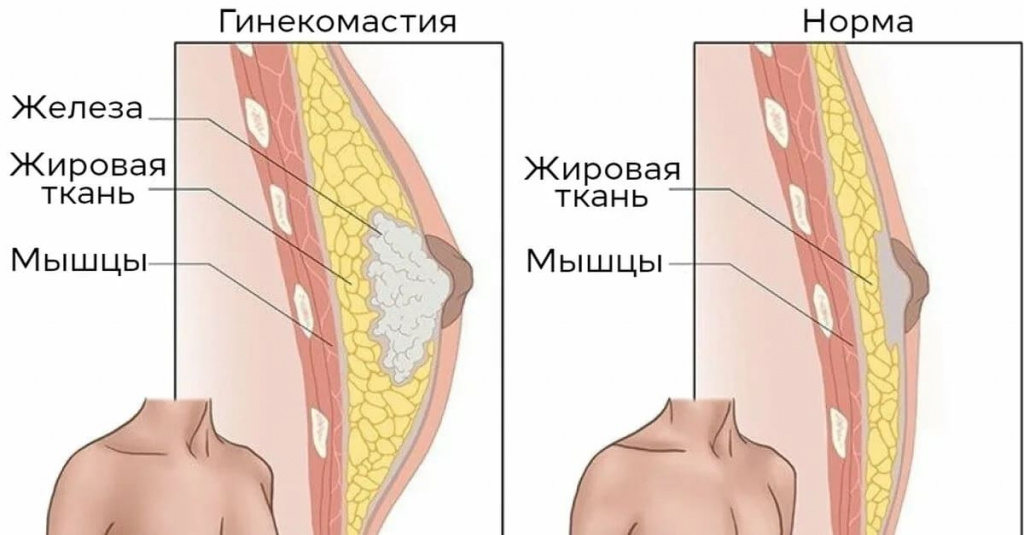 scale_1200.jpg